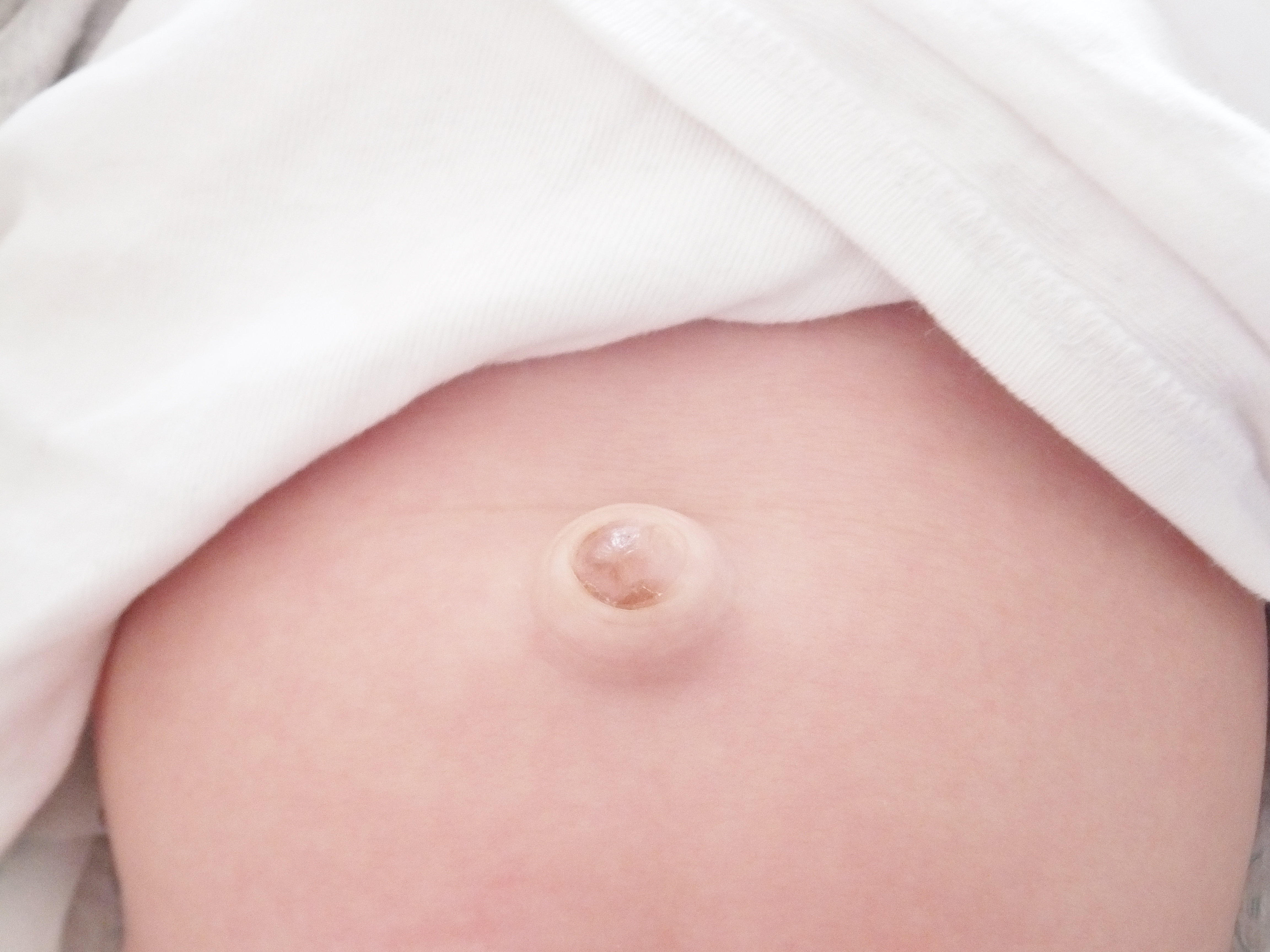 でべその意味は 種類や英語表記はある お前の母ちゃんでべその歌の続きは 意味 語源由来 違い 使い方をまとめたふむぺでぃあ